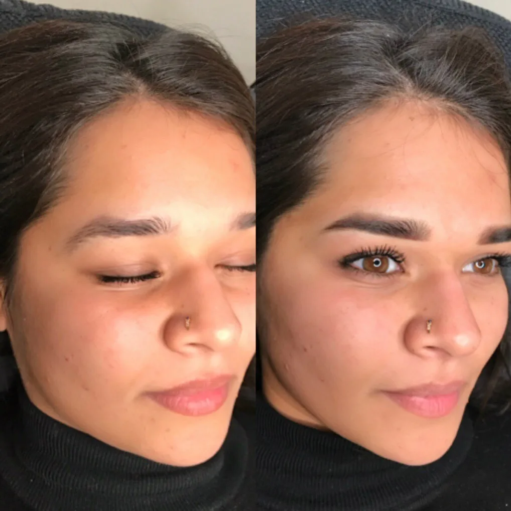 F&oslash;r og efter permanent makeup, set i halvprofil