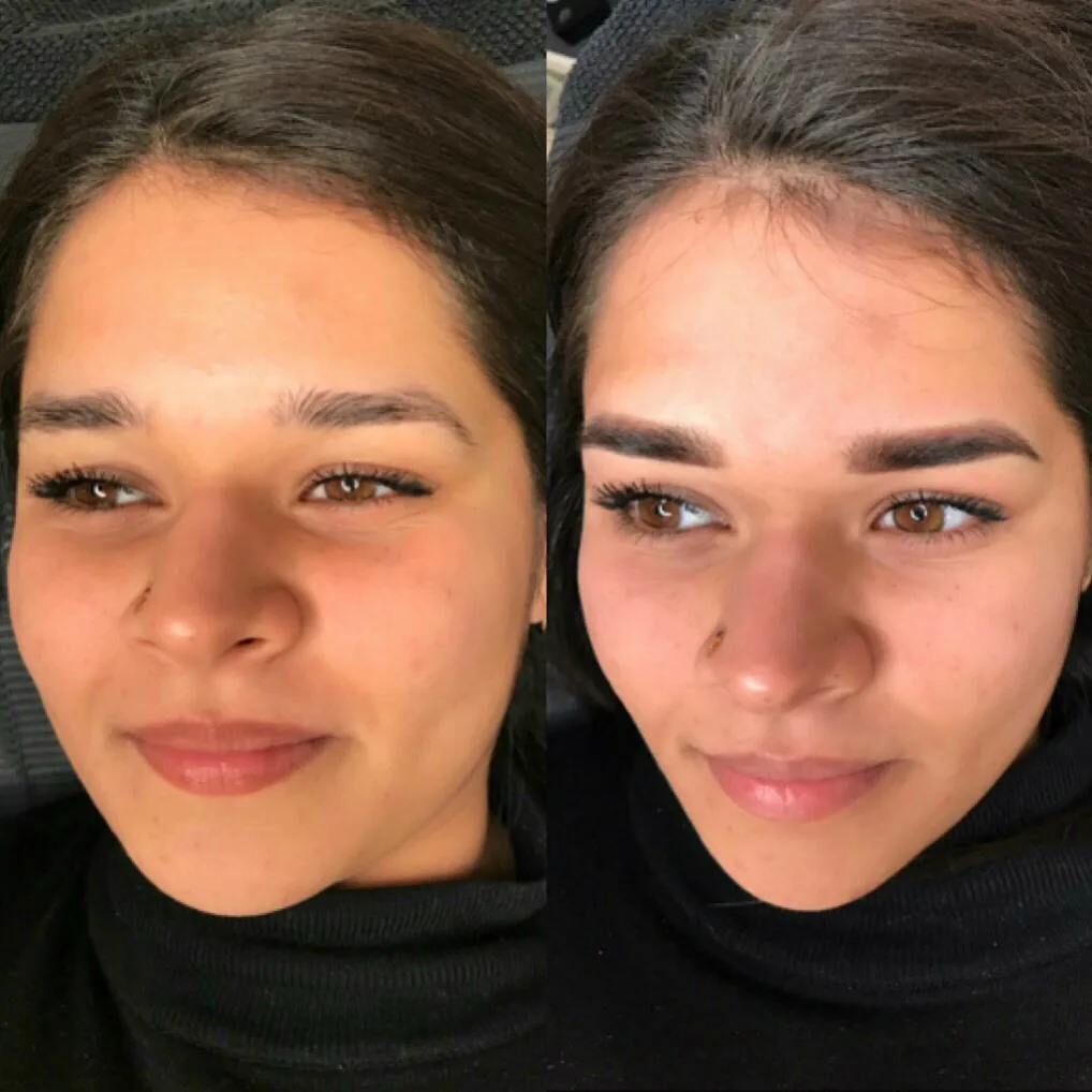 F&oslash;r og efter permanent makeup, set forfra